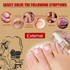 Эссенция EELHOE для восстановления ногтей, сыворотка для лечения грибков ногтей, удаление онихомикоза на ногах, питающая, осветляющая, уход за кожей рук и ног, TSLM2