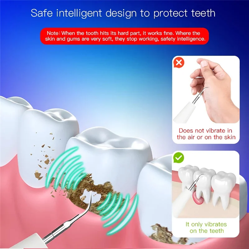 

Electric Portable Ultrasonic Dental Scaler Tooth Calculus Remover Tooth Stain Tartar Cleaner Dentist Whiten Teeth Oral Care Tool