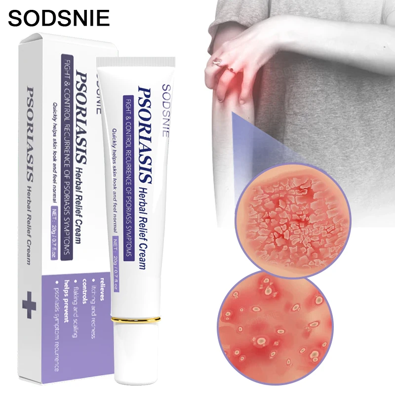 

Psoriasis Herbal Relief Cream Dermatitis Eczema Ointment Treatment Relieve Itching Non-Irritating Body Healthy Skin Care 20g