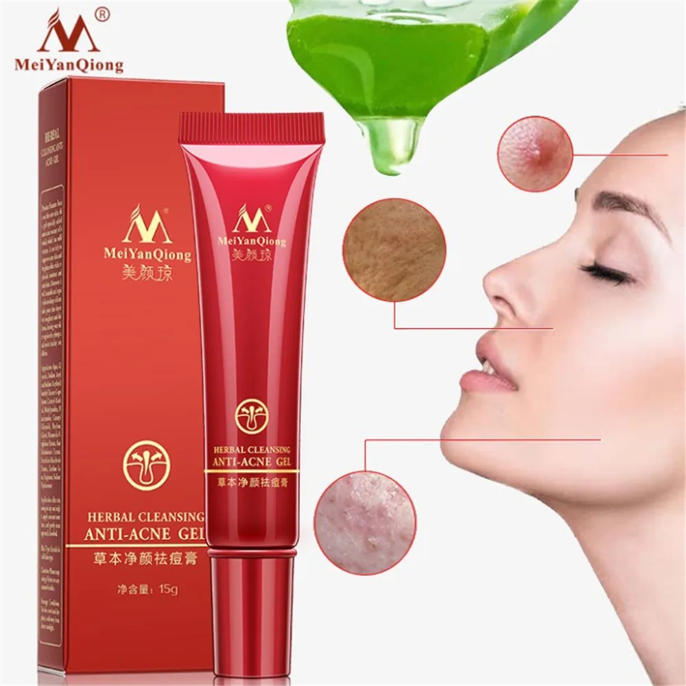 

Effective Acne Removal Cream Herbal Anti-acne Repair Fade Acne Spots Oil Control Whitening Moisturizing Face Gel Skin Care 15g