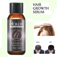 30ml anti hair loss growth serum essential oil stimulates follicle strengthen roots promoting improve solid hair loss care