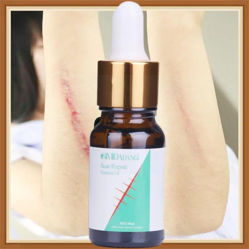 

10ml Lavender Scar Repair Skin Essential Oil Remove Repair Stretch Skin Body Surgical Marks Scars Care E1D3