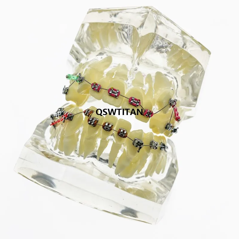 Стоматологическая Ортодонтическая модель зубов прозрачная с кронштейнами |