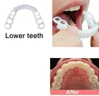 Хит, идеальная улыбка, накладка на зубы, накладные зубы, виниры, белые зубы, отбеливание зубов, накладные зубы, косметический уход за зубами