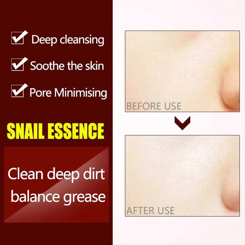 Очищающее Средство LAIKOU с экстрактом улитки глубокое очищение пор антивозрастной