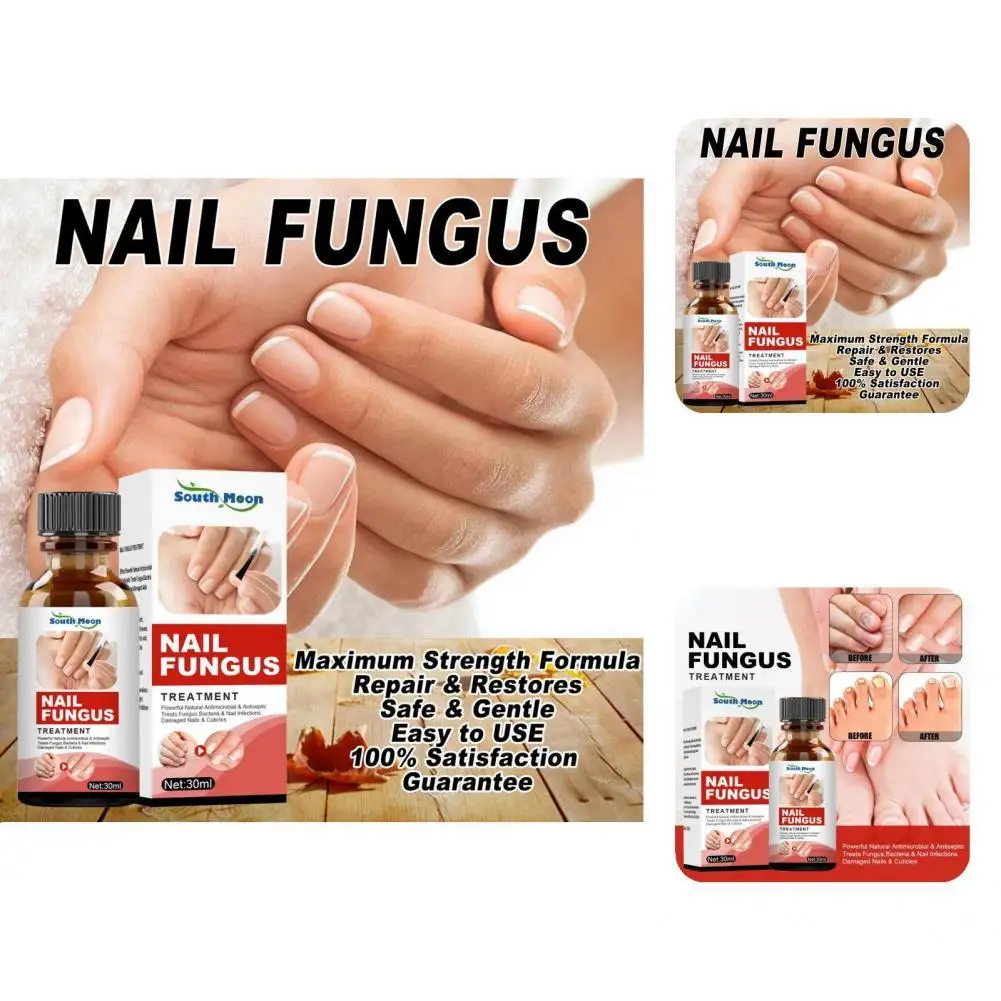 

30ml Useful Herbal Extracts Lightweight Pedicure Nail Repair Liquid for Feet Nail Treatment Essence Nail Repair Liquid