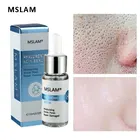 Сыворотка для сужения пор, гиалуроновая кислота, питание, увлажнение, сухость, восстановление кожи, лечение, эссенция, жидкость