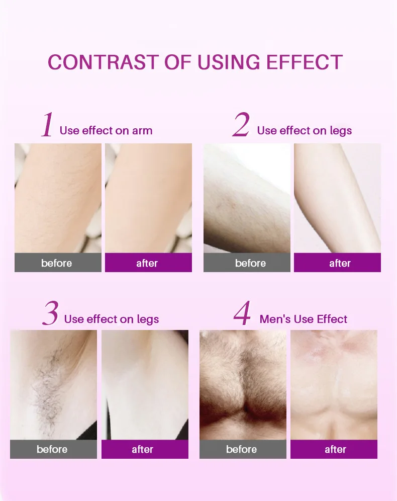 Безболезненный крем для удаления волос спрей депиляции воск тела Бикини ног пена