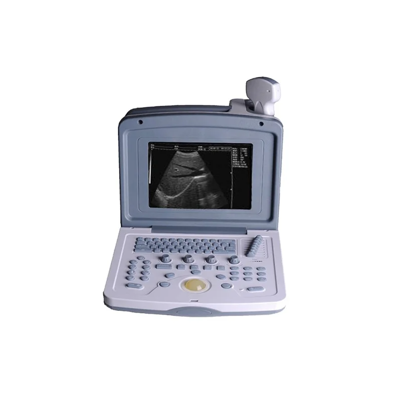 

High quality cheapest-portable-ultrasound-machine portable ultrasound machine for animal portable ultrasound scan machine