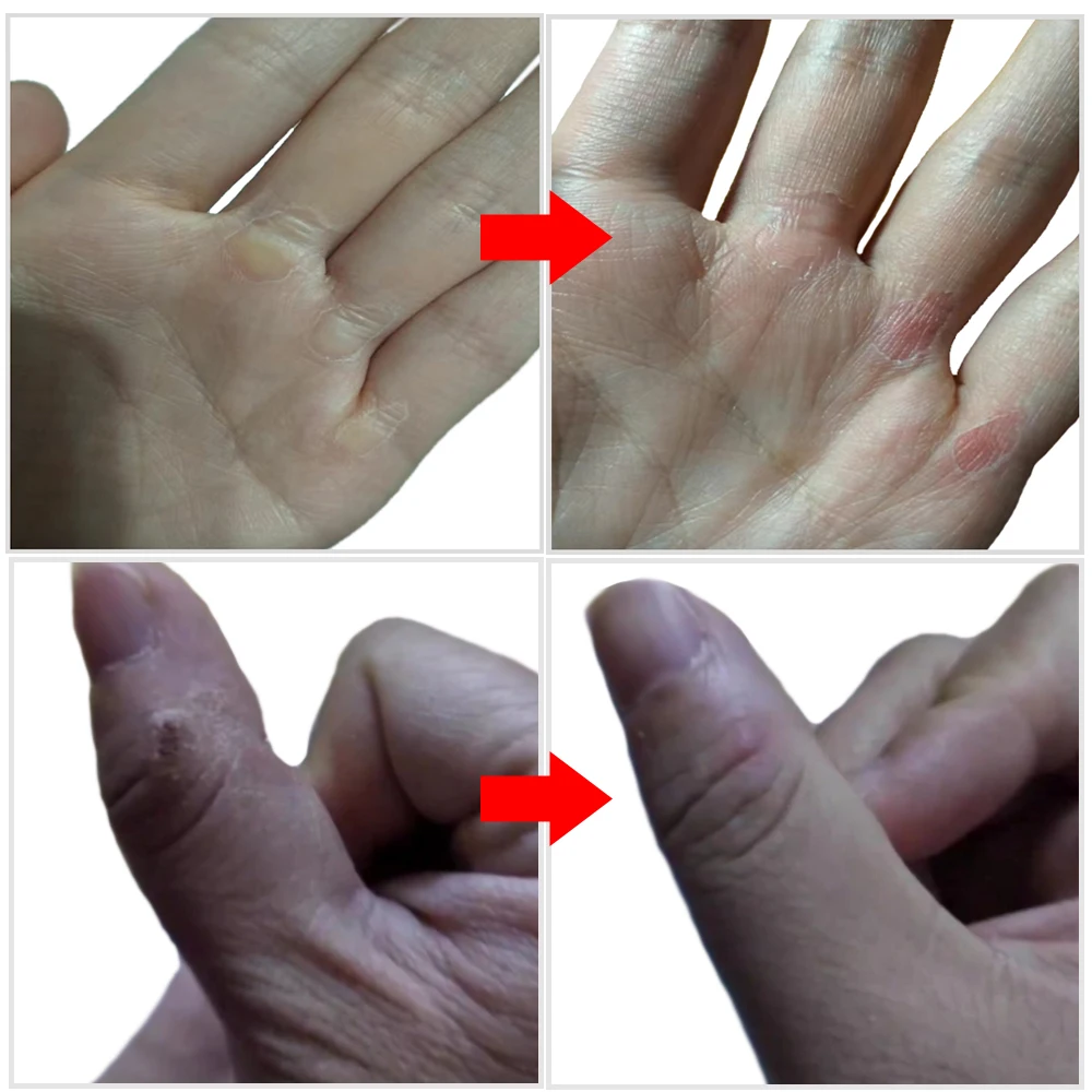 Отшелушивающая Маска-пилинг для ног мозоли ороговелости удаления омертвевшей