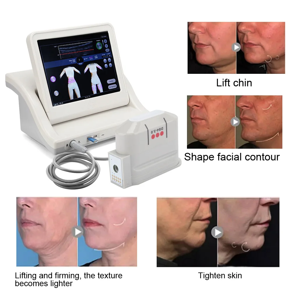 Professional Ultrasound Instrument DS4-3.0 Probe Beauty Machine Dedicated Accessories Dermis Probe Beauty Salon Facial Care Tool
