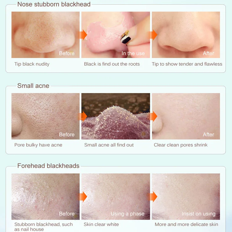 Маска для глубокого очищения Очищающая маска лица удаления черных точек акне