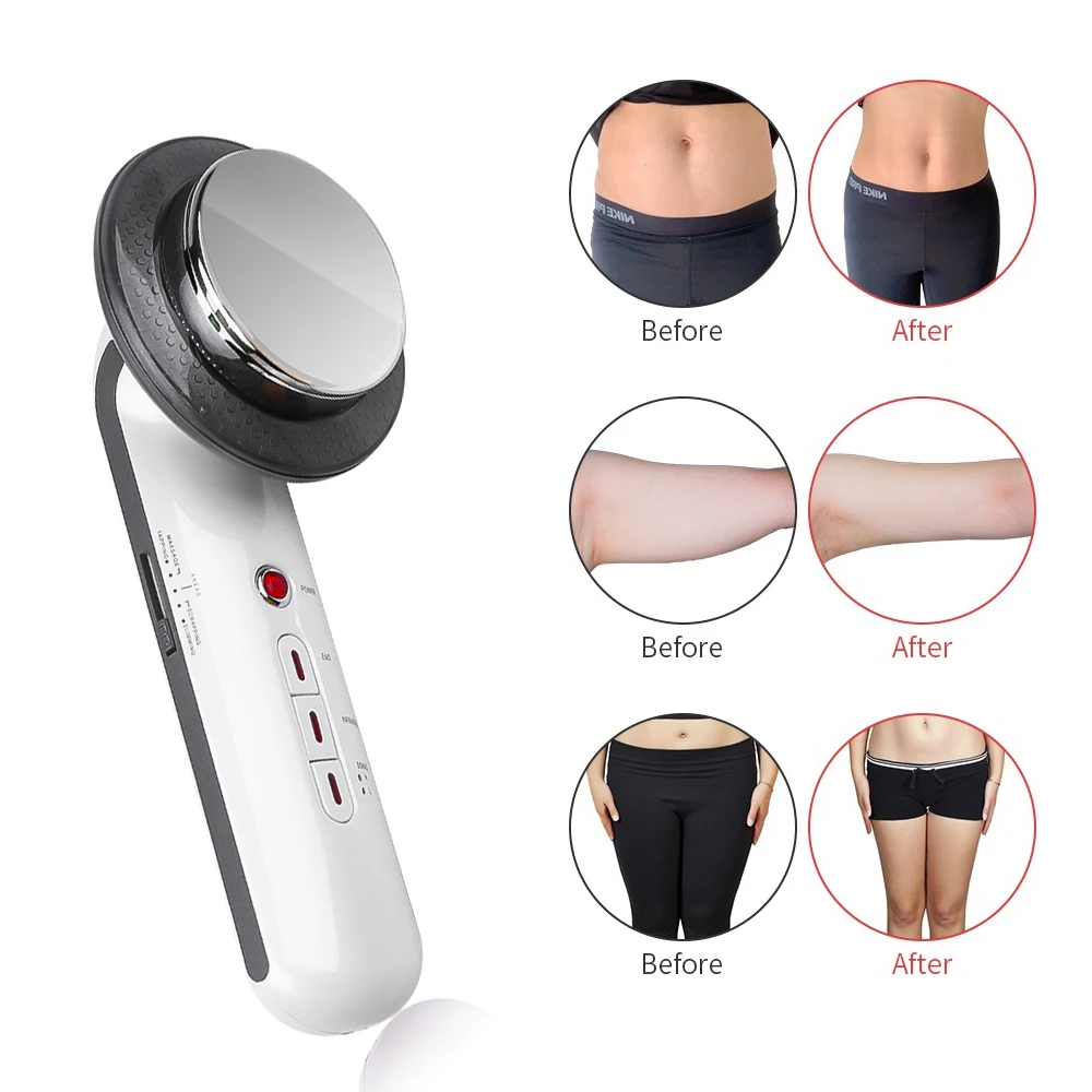 Портативные вакуумные банки для похудения и скульптурирования тела