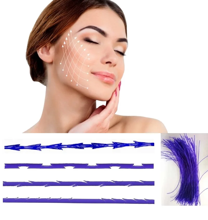 Корейская нить лифтинг лица шеи рук ног ягодиц подтяжка 10 дюймов косметические