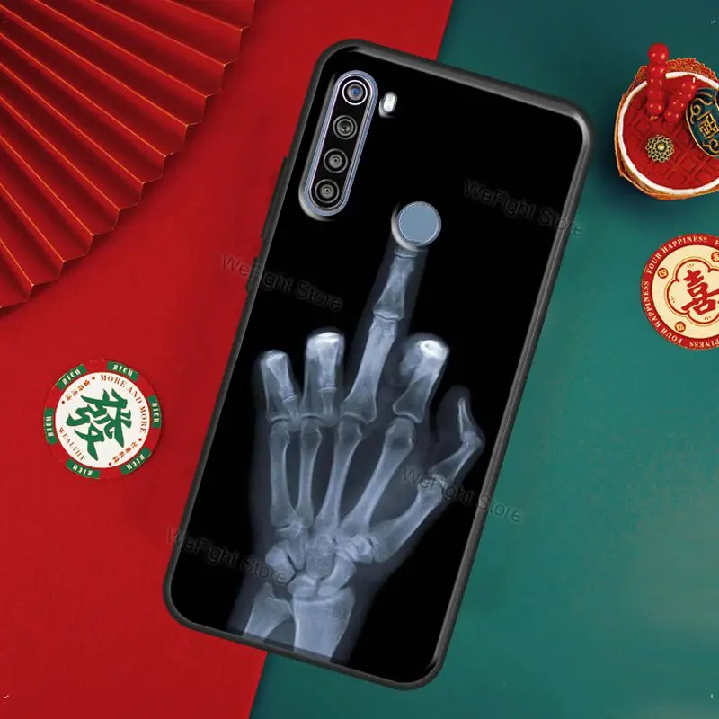 Чехол со скелетом на средний палец для Xiaomi Redmi Note 11 Pro 8 9 10 9S 10S чехол 9A 9C 9T |