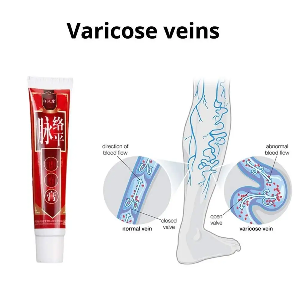 Крем для лечения варикозного расширения вен лечение Варикозного ангиит