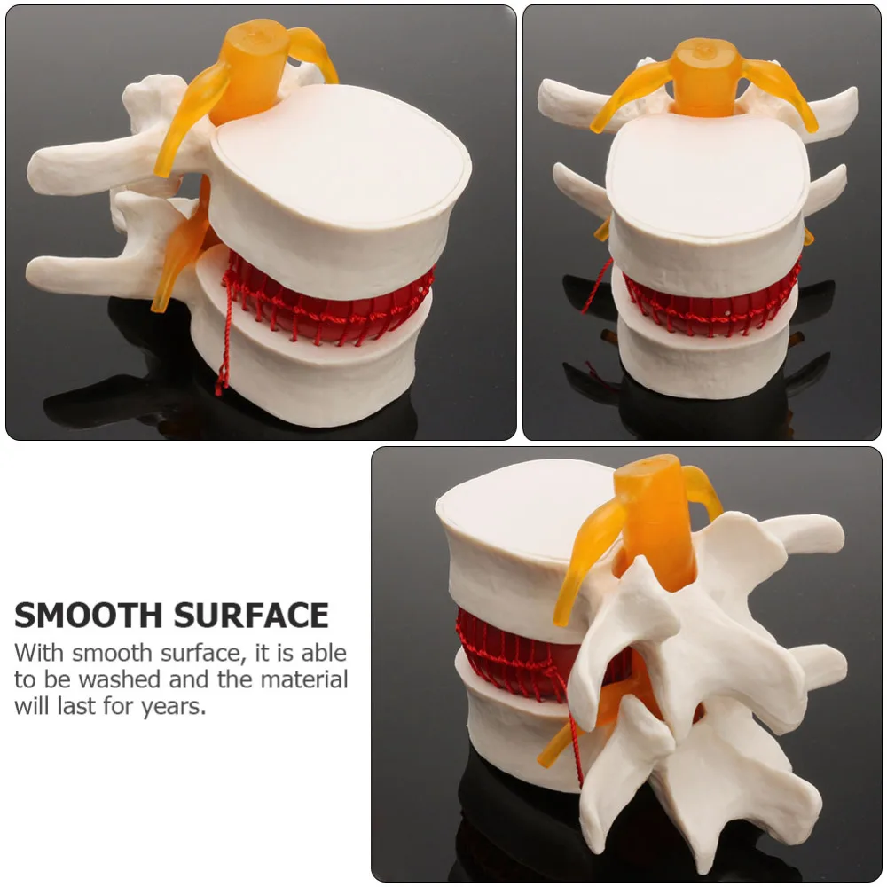 

1pc Human Lumbar Disc Herniation Demonstration Model for Lumbar Spine Teaching