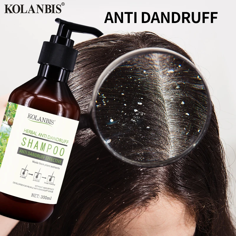 

hair care organic herbal natural sulfate free anti dandruff tea seeds hair shampoo for stop itching and Oily hair