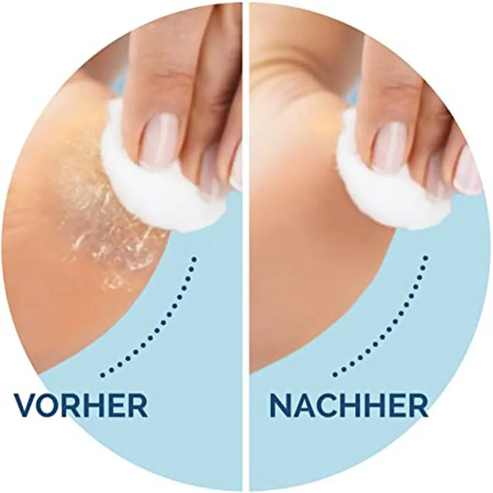 1PCS Foot care tool Heads Pedi Hard Skin Remover Refills Replacement Rollers For Scholls File Feet Tool | Красота и здоровье