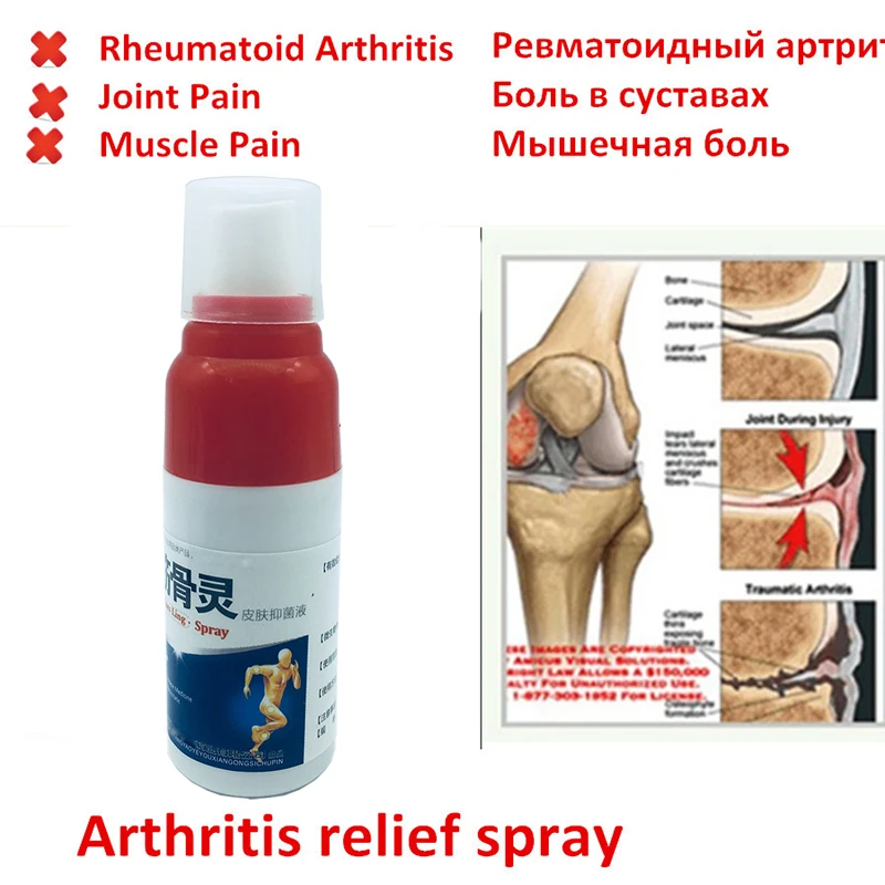 

Pain Relief Spray Rheumatism Arthritis, Muscle Sprain Knee Waist Pain, Back Shoulder Spray Tiger Orthopedic Plaster