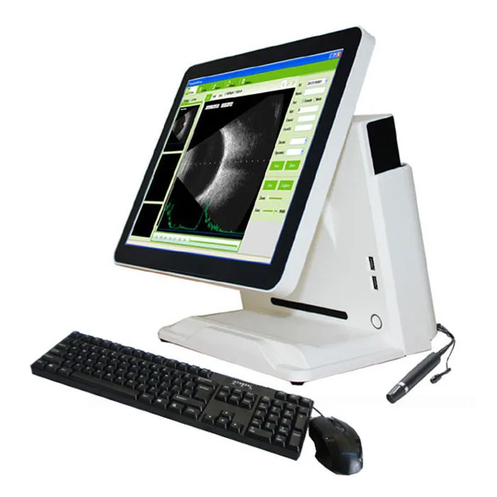 

CAS-2000D china best quality ophthalmic ultrasound ab Scan