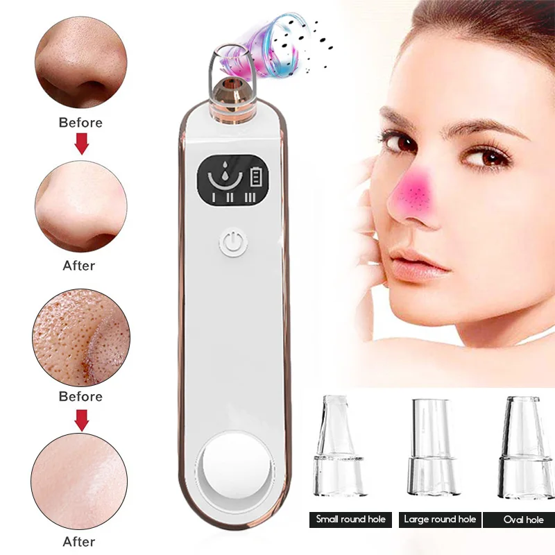 Вакуумный аппарат для очистки пор от угрей вакуумный экстрактор инструмент
