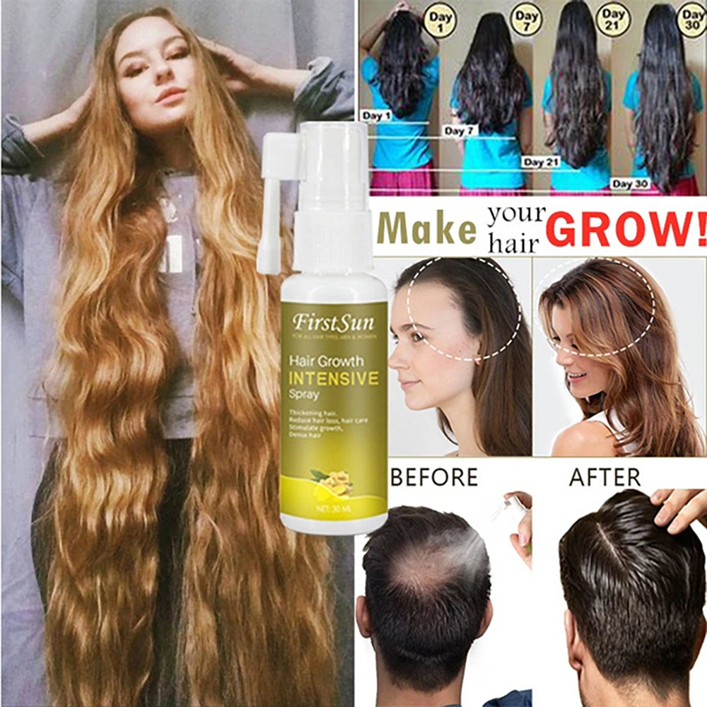 30ml Ginger Hair Growth Essence Spray Hair loss Treatment Preventing Hair Loss spray hair Growth Essence Hair Care Free shipping