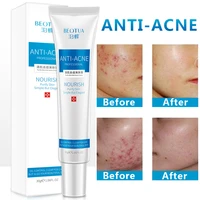 30ml acne cream anti acne face water oil balance acne remover cream acne scar treatment effectively remove pimple scar cream