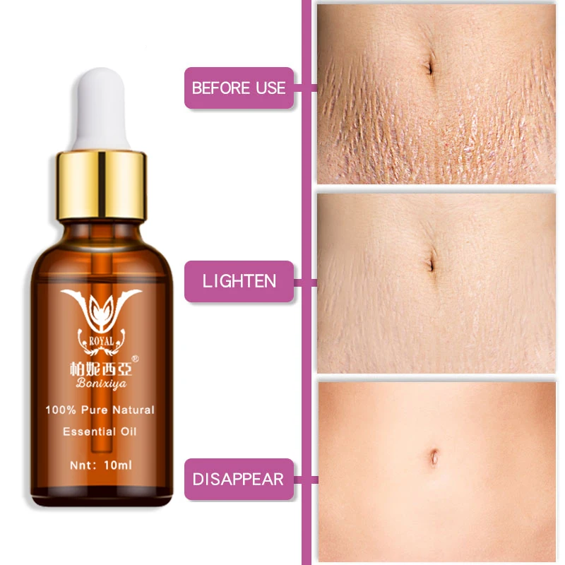 

30ML Stretch Marks Remover Essential Oil Eliminate Pregnancy Scars Maternity Repair Anti Winkle Skin Firming Treatment
