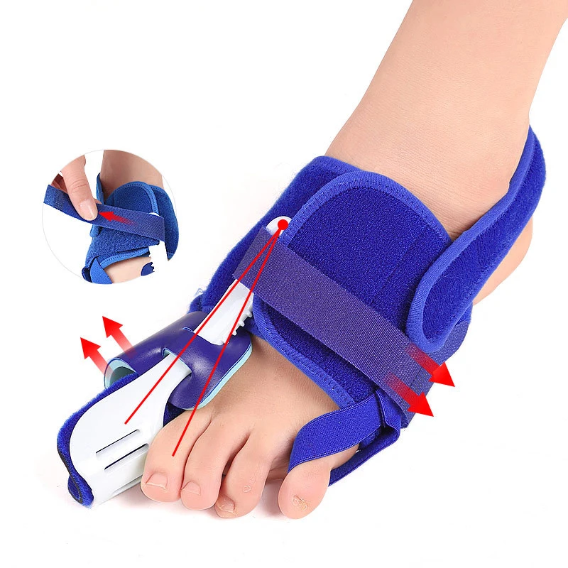 

Профессиональный корректор Hallux вальгус палец ноги разделитель для ухода за ногами большого пальца ежедневные ортопедические инструменты
