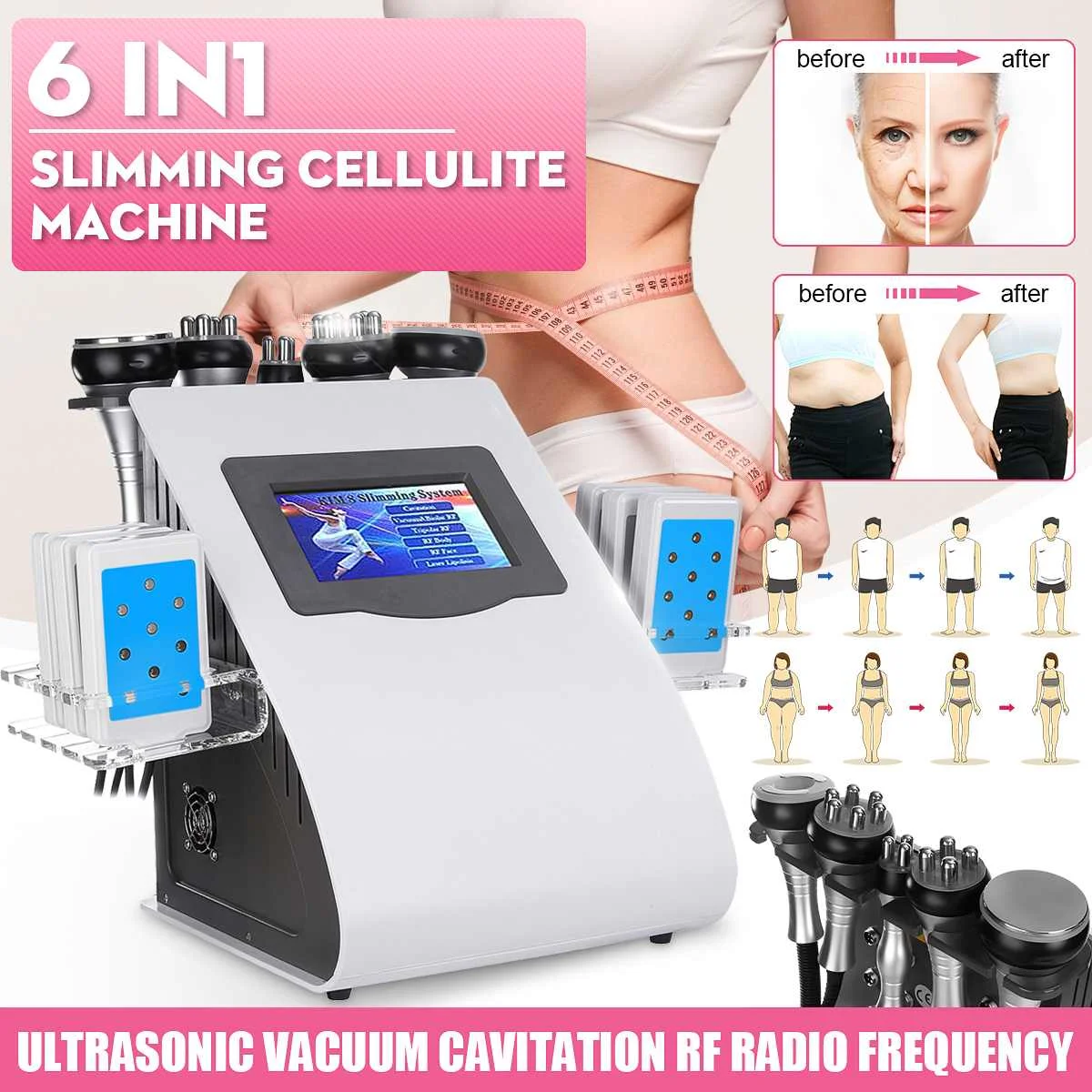 

6 in 1 Ultrasonic Cavitation Vacuum Radio Frequency Laser Lipo Laser Slimming Machine For Home Use 8 Pads Blue Laser Board