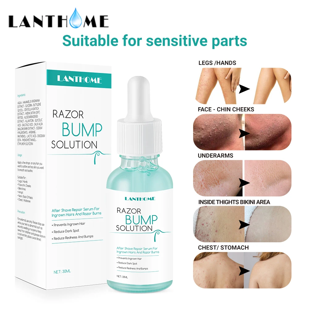 

LANTHOME 30ml Repair Serum After Hair Removal Prevent Ingrown Hairs and Razor Bump Body Treatment Smooth Skin Reduce Dark Spots