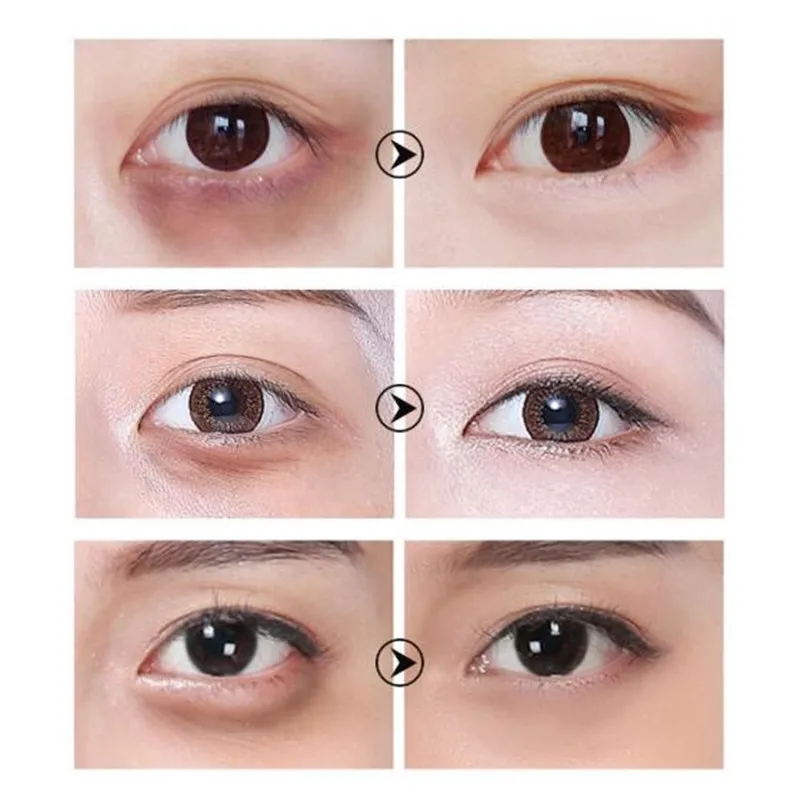 LANBENA гидрогелевые патчи под глаза для глаз лица против морщин подушечки тускнеют