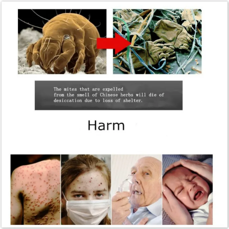 10 упаковок натуральная клещевая сумка для удаления клещей убийца кровать