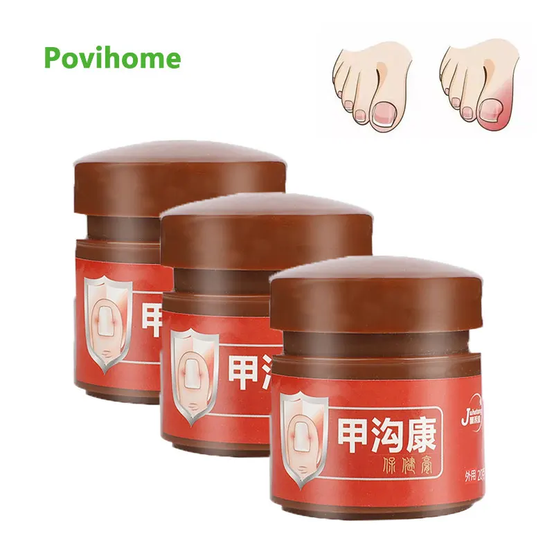 

20g Fungal Nail Repair Removal Cream Remove Gel Anti Infection Paronychia Ointment Onychomycosis Herbal Medical Plaster