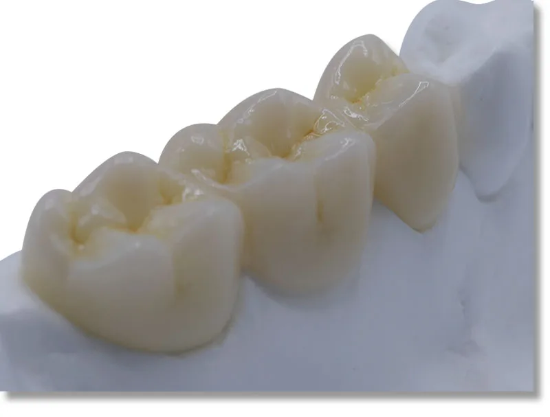 5 шт. ST + cerec(40/19 мм) система 2019 мм Beautyzir прозрачность Sirona CAD CAM стоматологический
