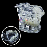 1pcs new dental study tooth transparent adult pathological teeth model dental lab equipment dentistteaching instrument tool
