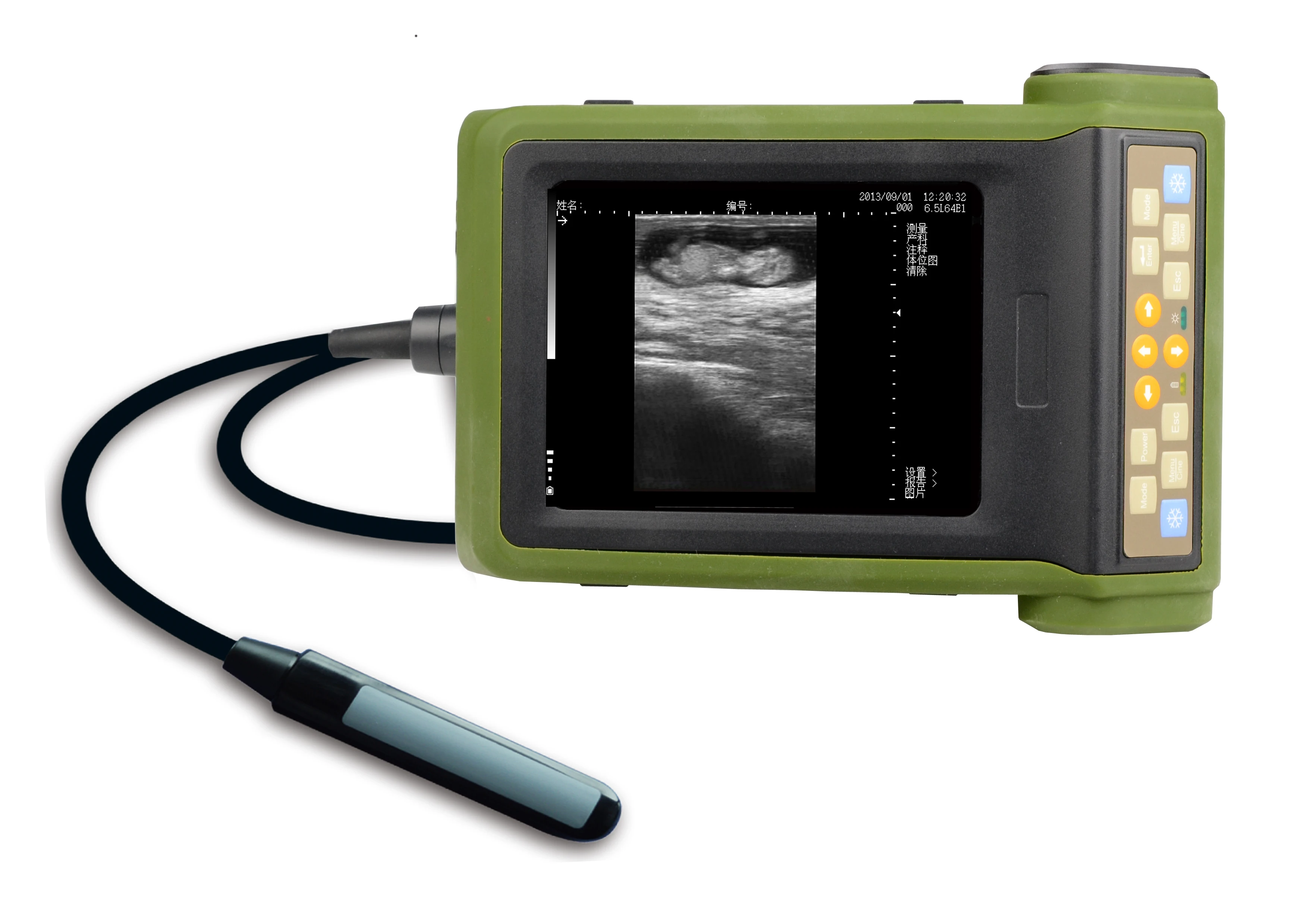 Полный цифровой Ветеринарный ультразвуковой сканер с ректальным зондом