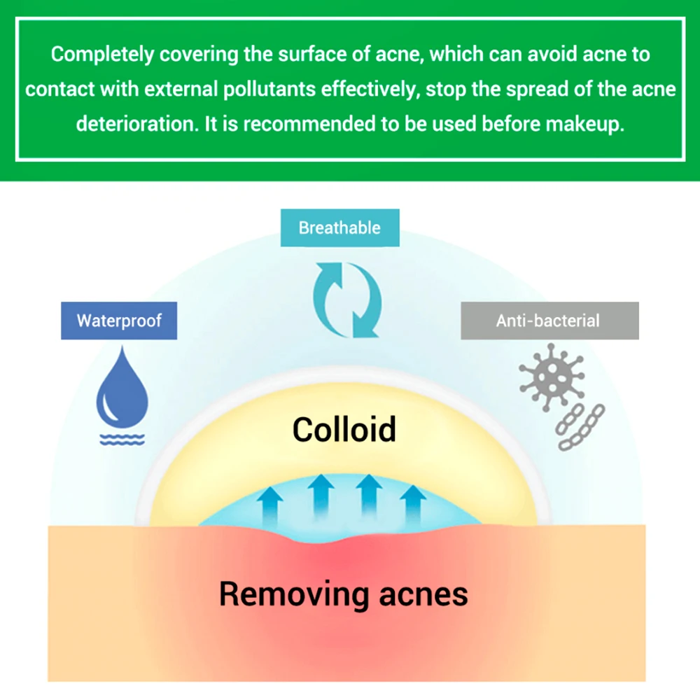 Пластырь от прыщей и акне пластырь для борьбы с пятнами удаления средство кожи