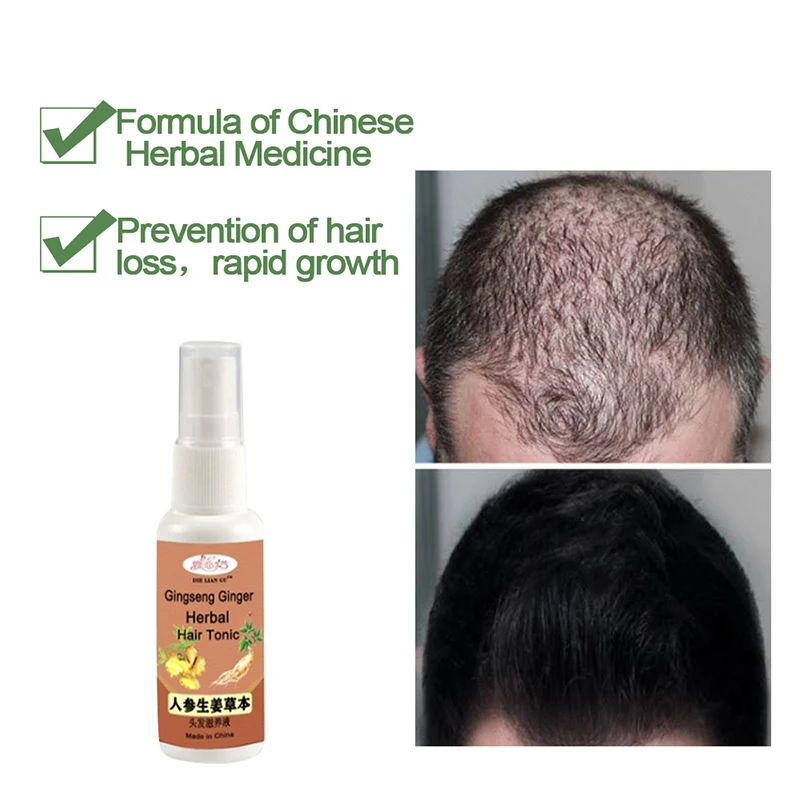 Высококачественный женьшень имбирь травяной тоник для волос питательный