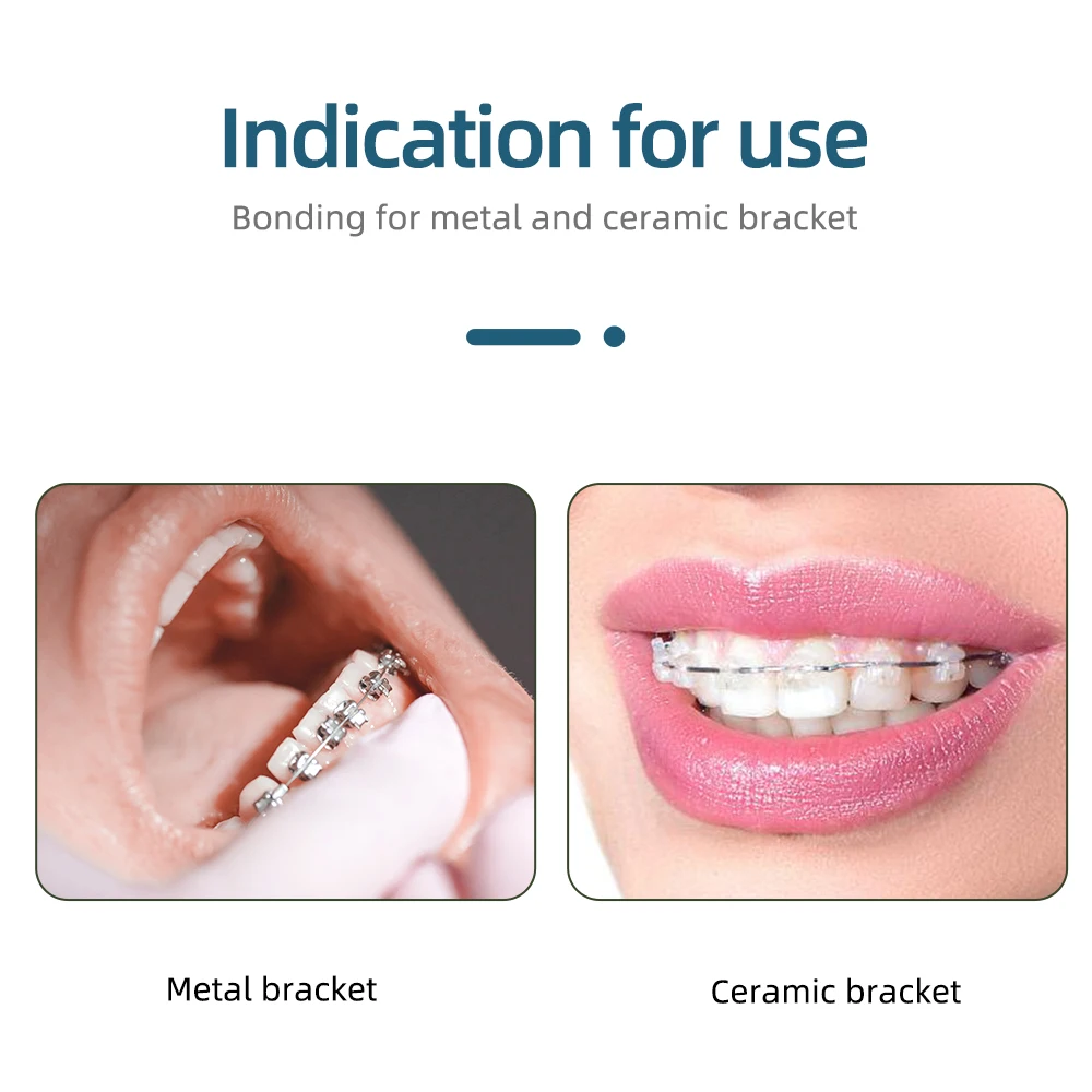 Стоматологическая Ортодонтическая склеивающая паста Легкий клей зеленый