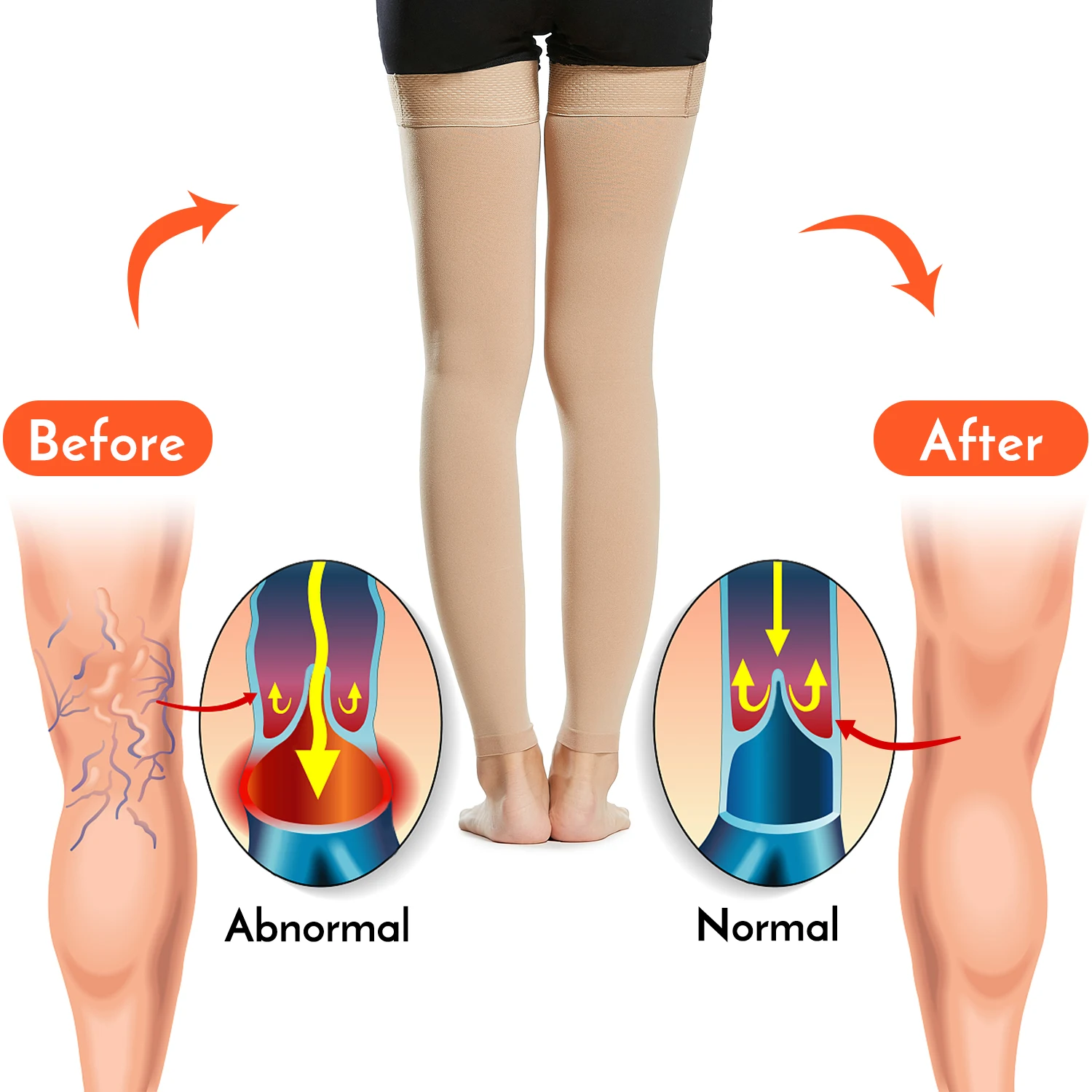 1 пара высокие Компрессионные носки для мужчин и женщин 20 30 мм. Рт. Ст.