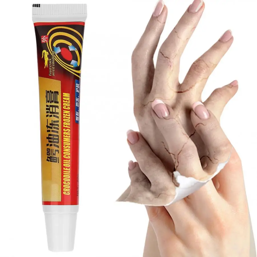 2 шт. детский уход за кожей рук ремонт мазь Лечение трещин питательный крем телом