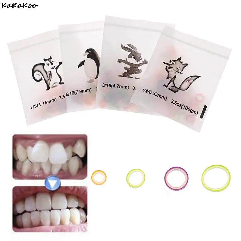 100 шт. Стоматологическая эластичная лента 4 размера Ортодонтическая Резиновая