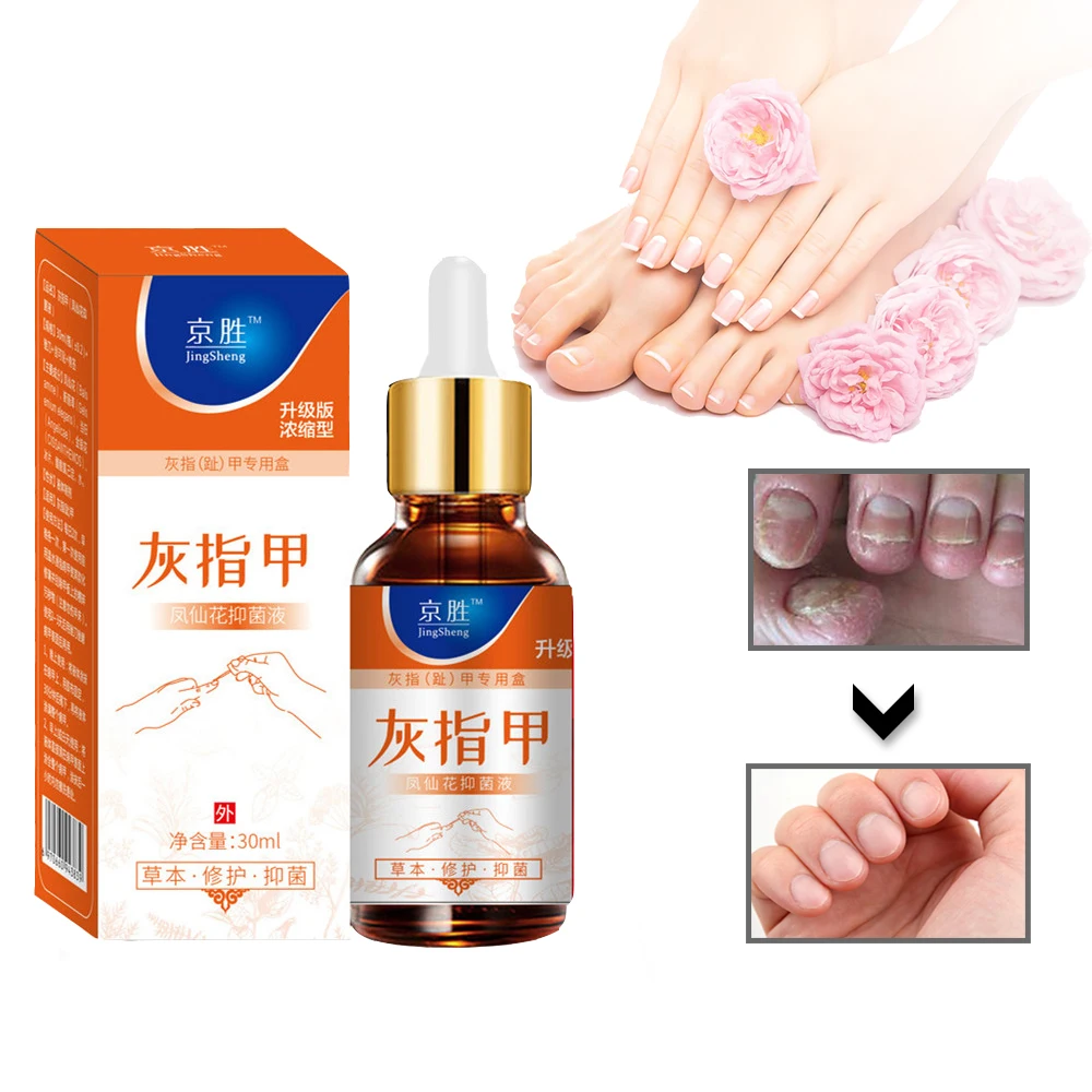 Восстановление ногтей онихомикоз средство для ухода за ногтями