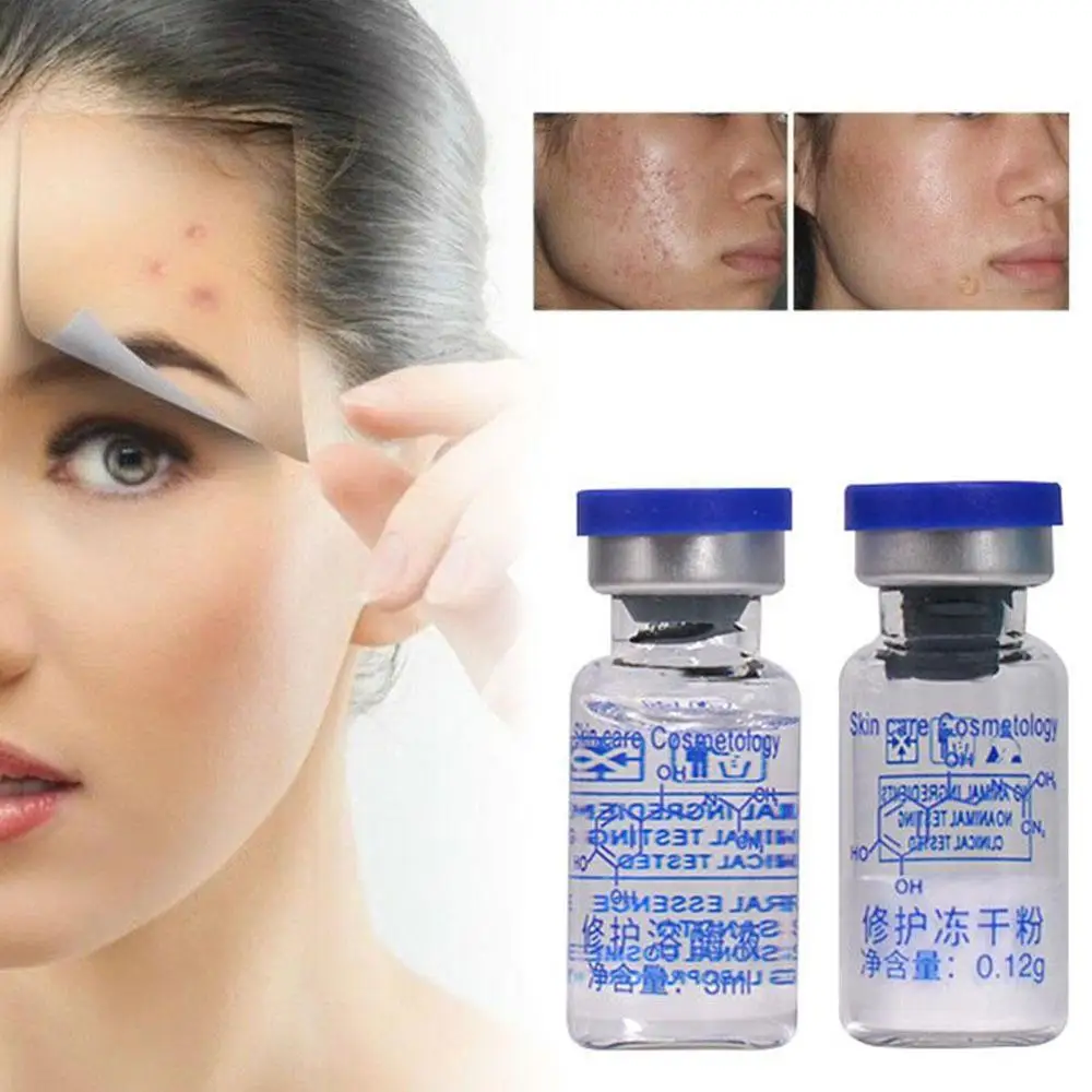 Original 1 Set Lyophilized Epidermal Growth Factor Scars Acne Serum Treatment Products Wrinkles Pimples Skin rhEGF Powder C Z5B9