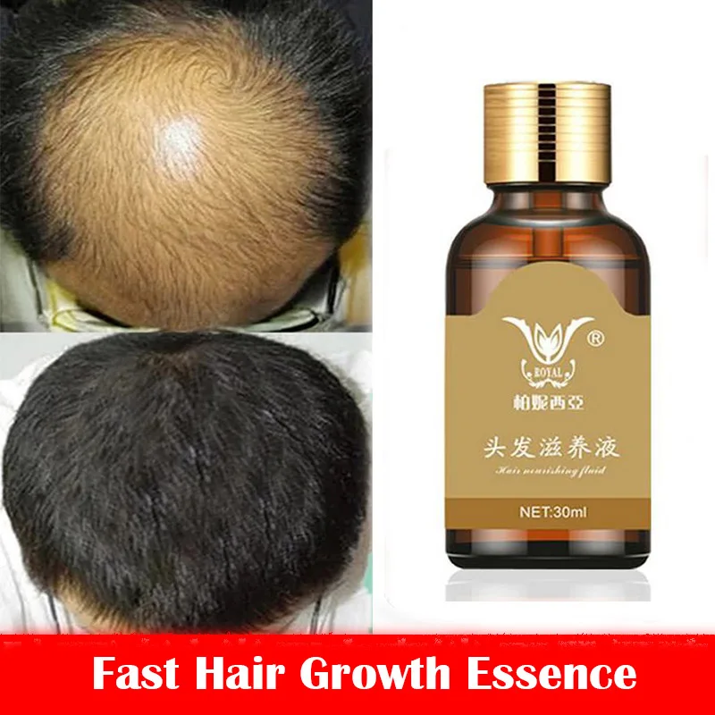 

Fast Hair Growth Essence Hair Loss Products Hair Growth Fibras Cabelo Shampoo Cremes De Tratamento Para Cabelos Hair Care