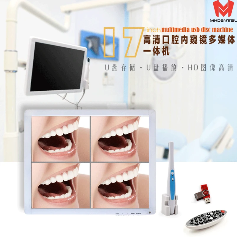 Интраоральная камера инструмент для отбеливания стоматологическое устройство