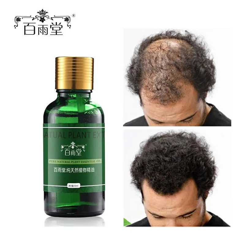 

Эфирные масла для ухода за волосами, 30 мл, эссенция для роста волос, оригинальная натуральная жидкость для выпадения волос 100%, уход за здоров...