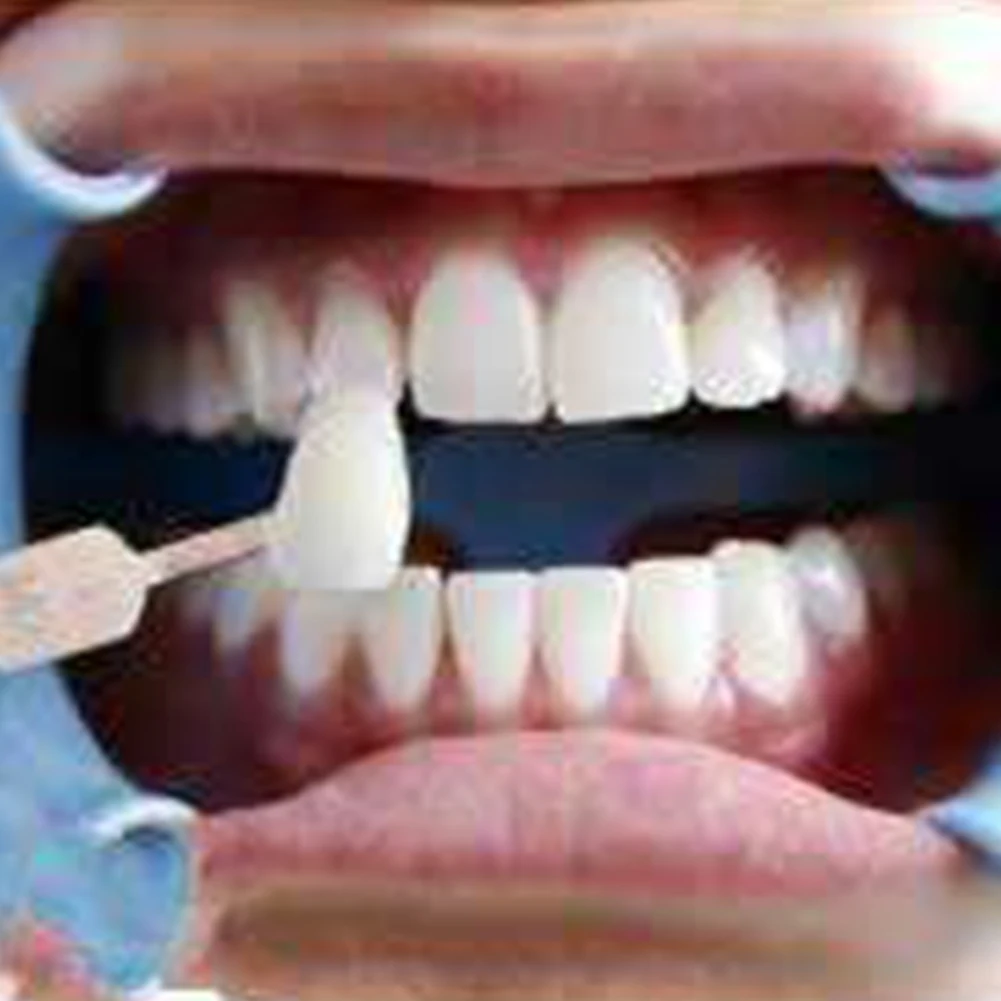 Холодный светильник для зубов Цветовая палитра стоматологический холодный